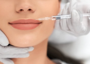 Natural-Looking Fillers Dominate 2025 Medspa Trends